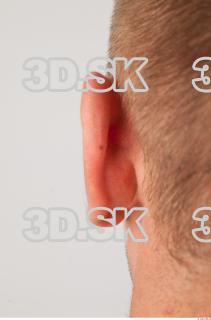 Ear texture of Gene 0001